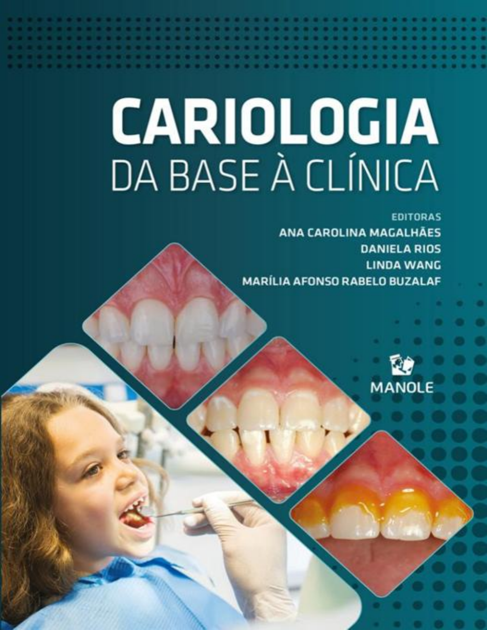 Livro Cariologia: Da Base à Clínica – Editora Manole