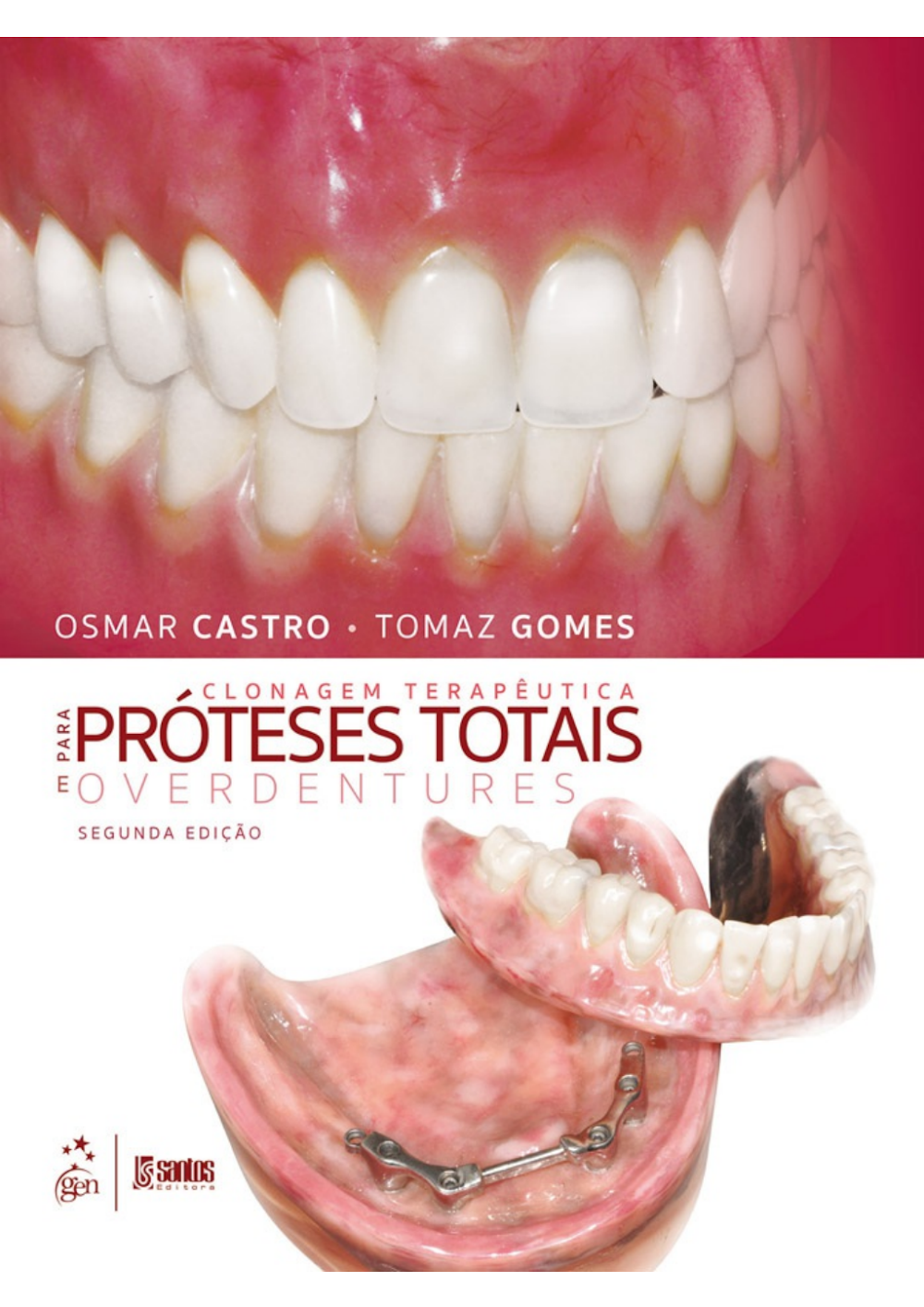 Clonagem Terapêutica em Próteses Totais e Overdentures