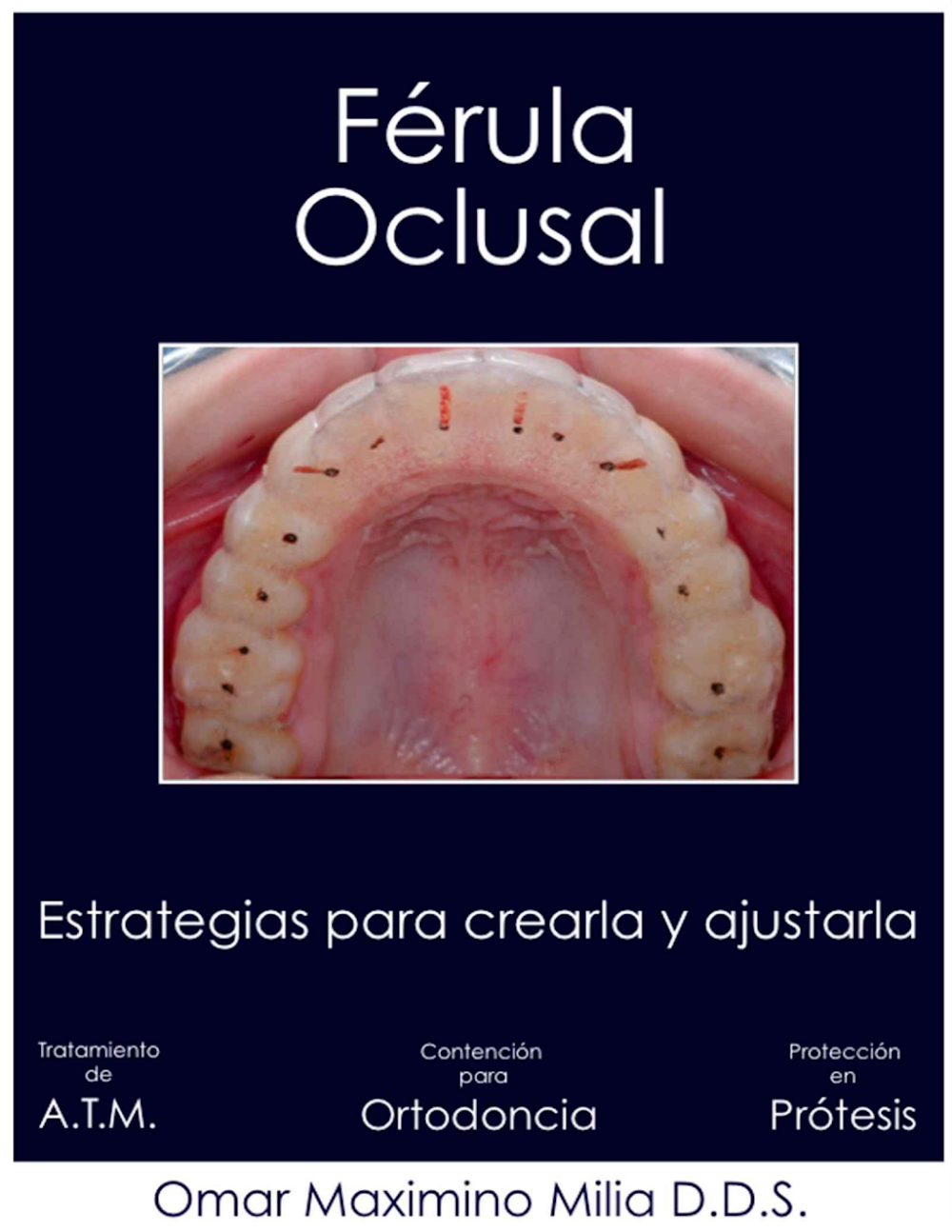 Férula Oclusal: Estratégias para Criação e Ajuste