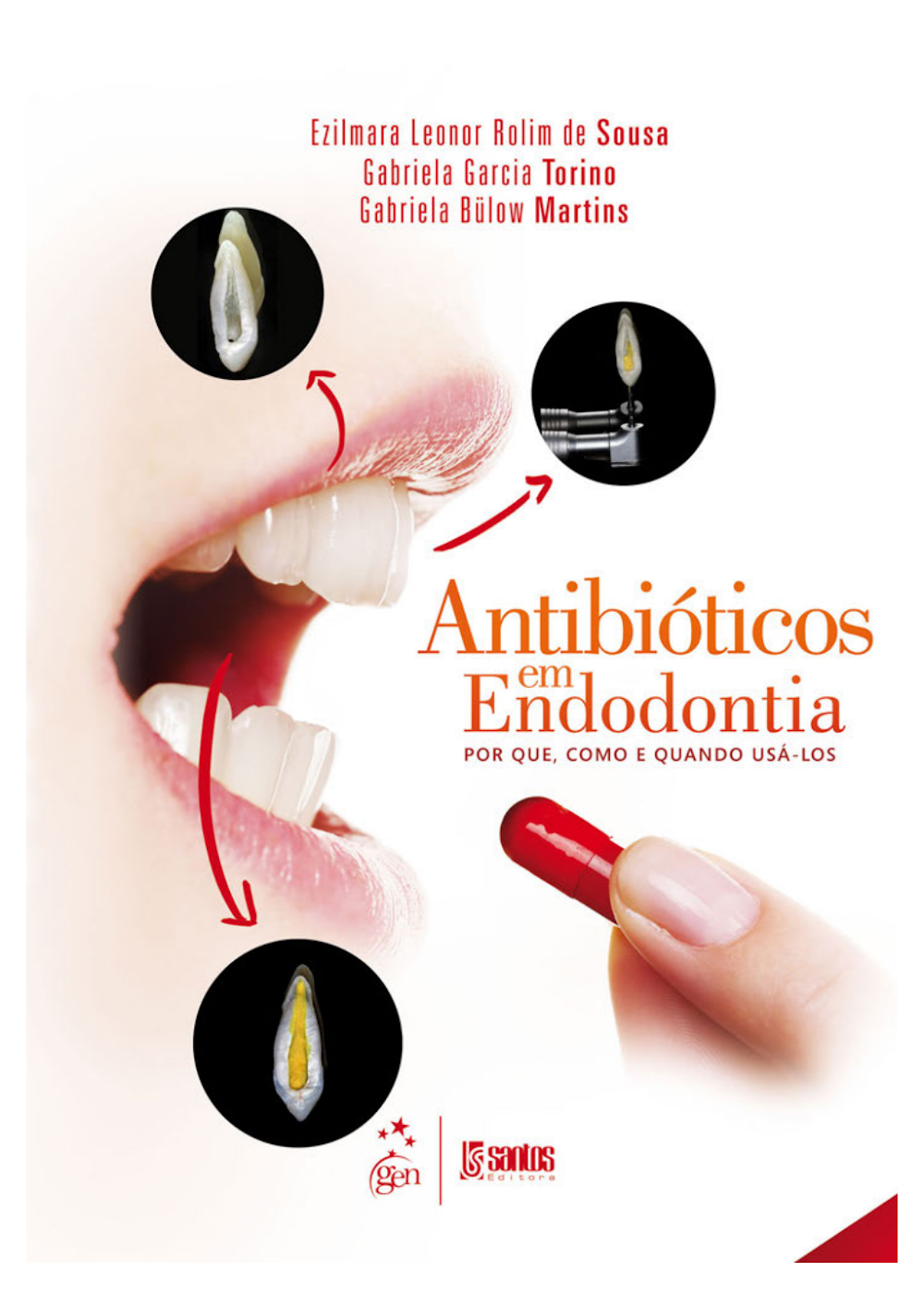 Livro: Antibióticos em Endodontia – Guia Clínico Completo