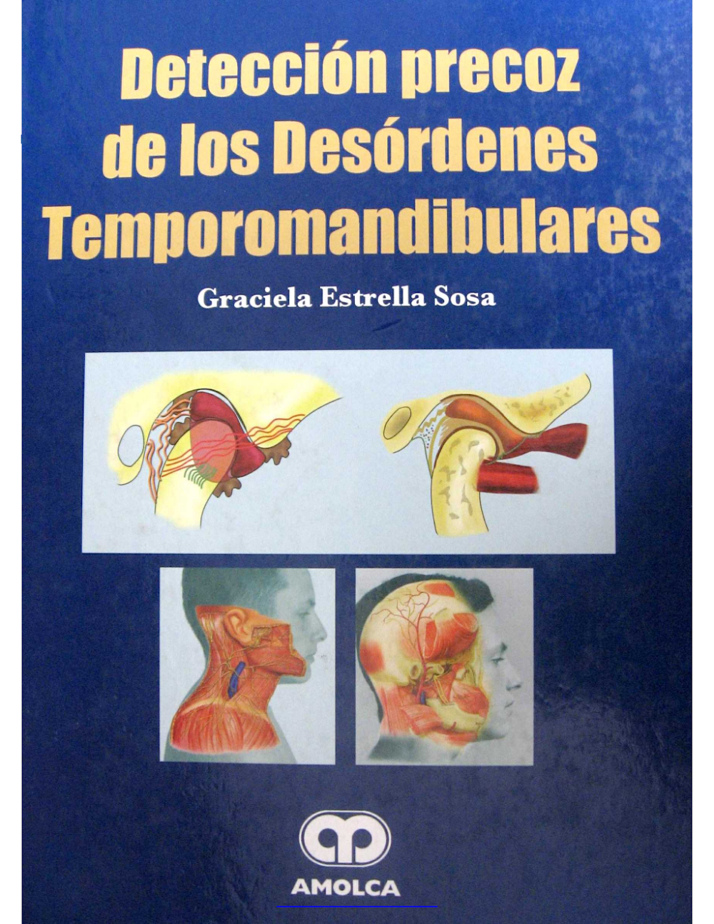 Detección Precoz Desórdenes Temporomandibulares: Guía Completa