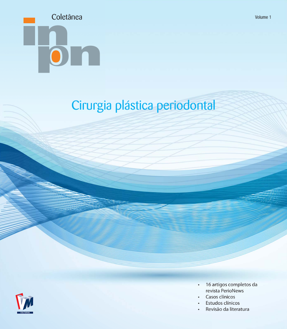 Coletânea Cirurgia Plástica Periodontal Vol. 1 – PerioNews