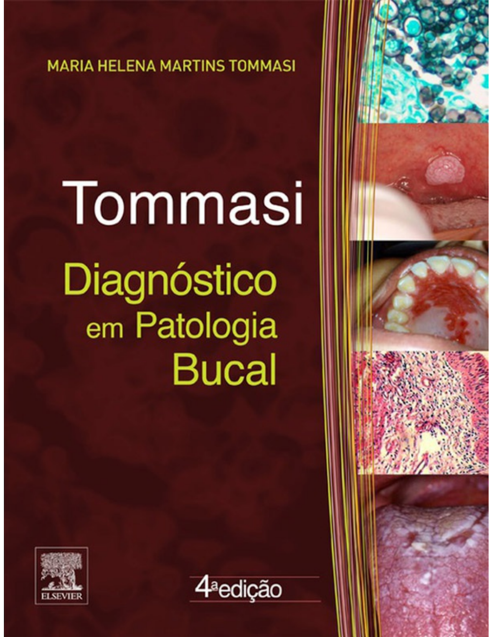 Diagnóstico em Patologia Bucal: Tommasi (4ª Edição) PDF