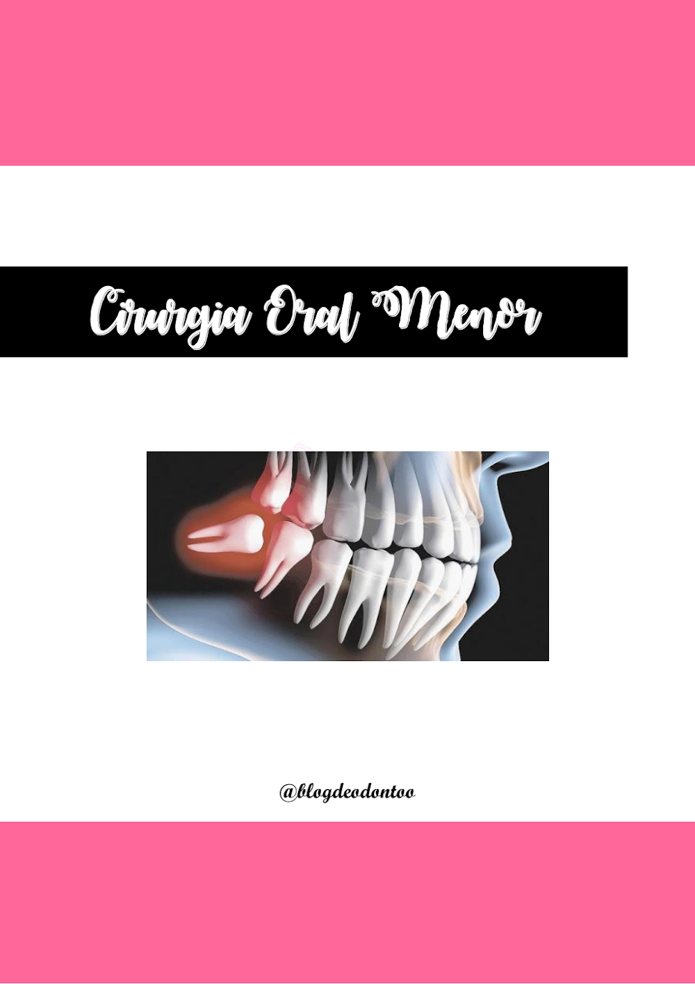 Apostila de Cirurgia Oral Menor: Guia de Procedimentos