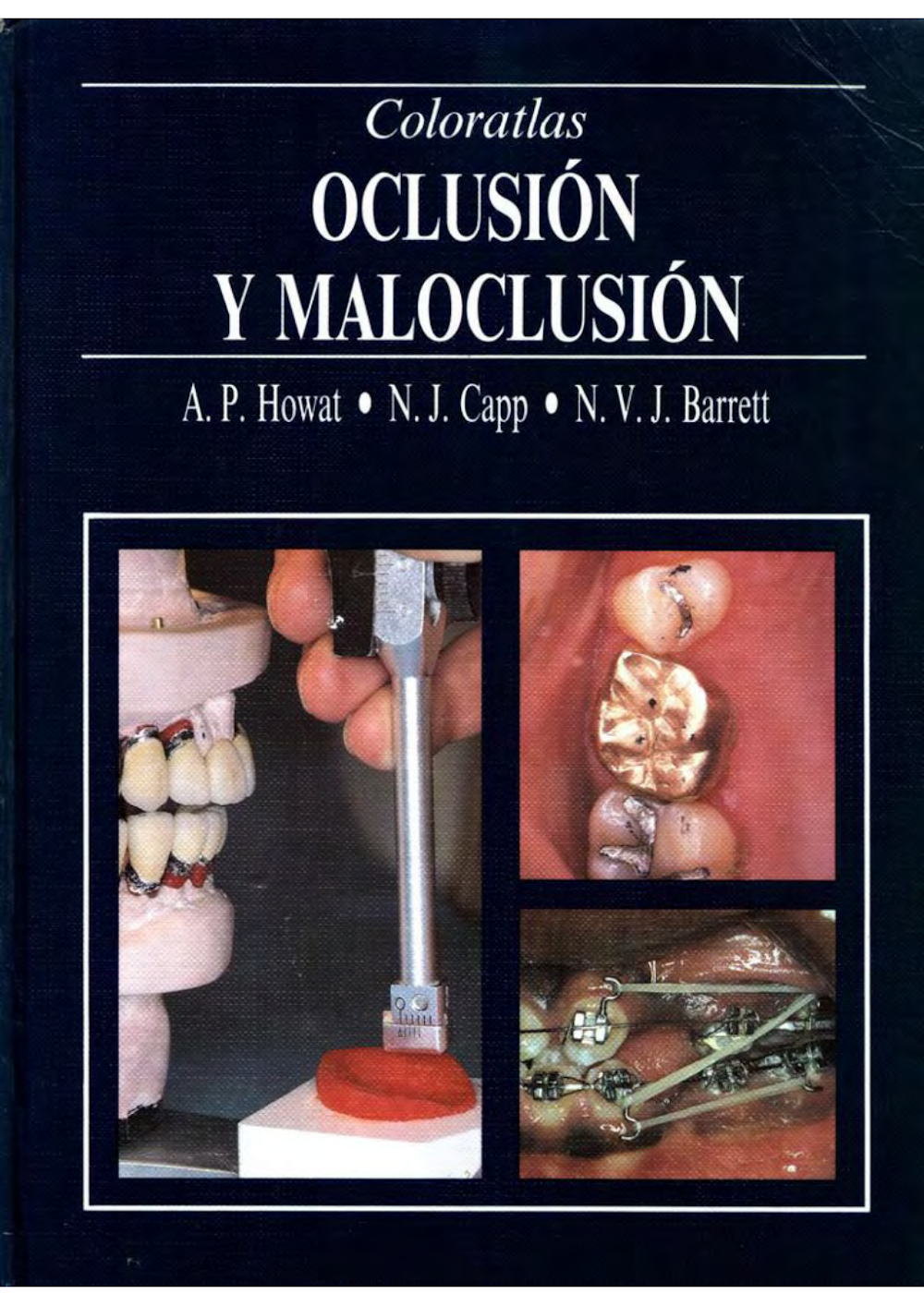 Oclusión y Maloclusión: Coloratlas Essencial em Odontologia