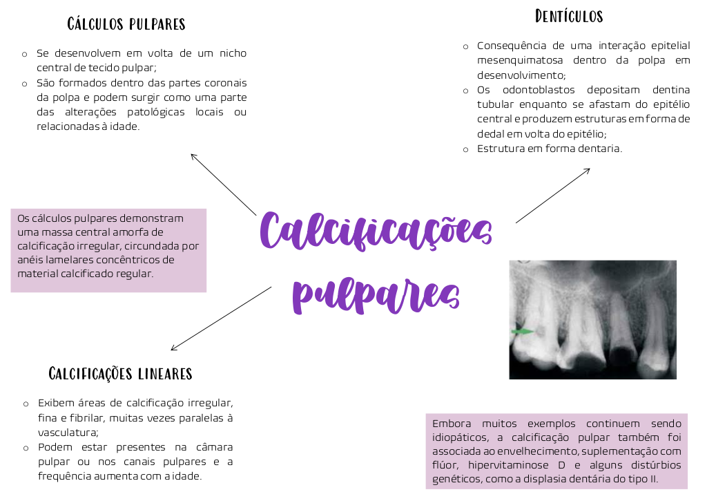 O que são Calcificações Pulpares: Tipos, Causas e Diagnóstico