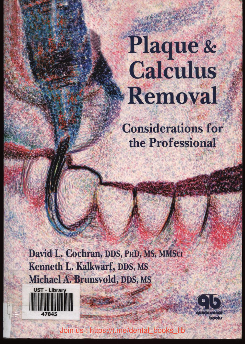 Remoção de Placa e Cálculo Dental: Técnicas e Orientações