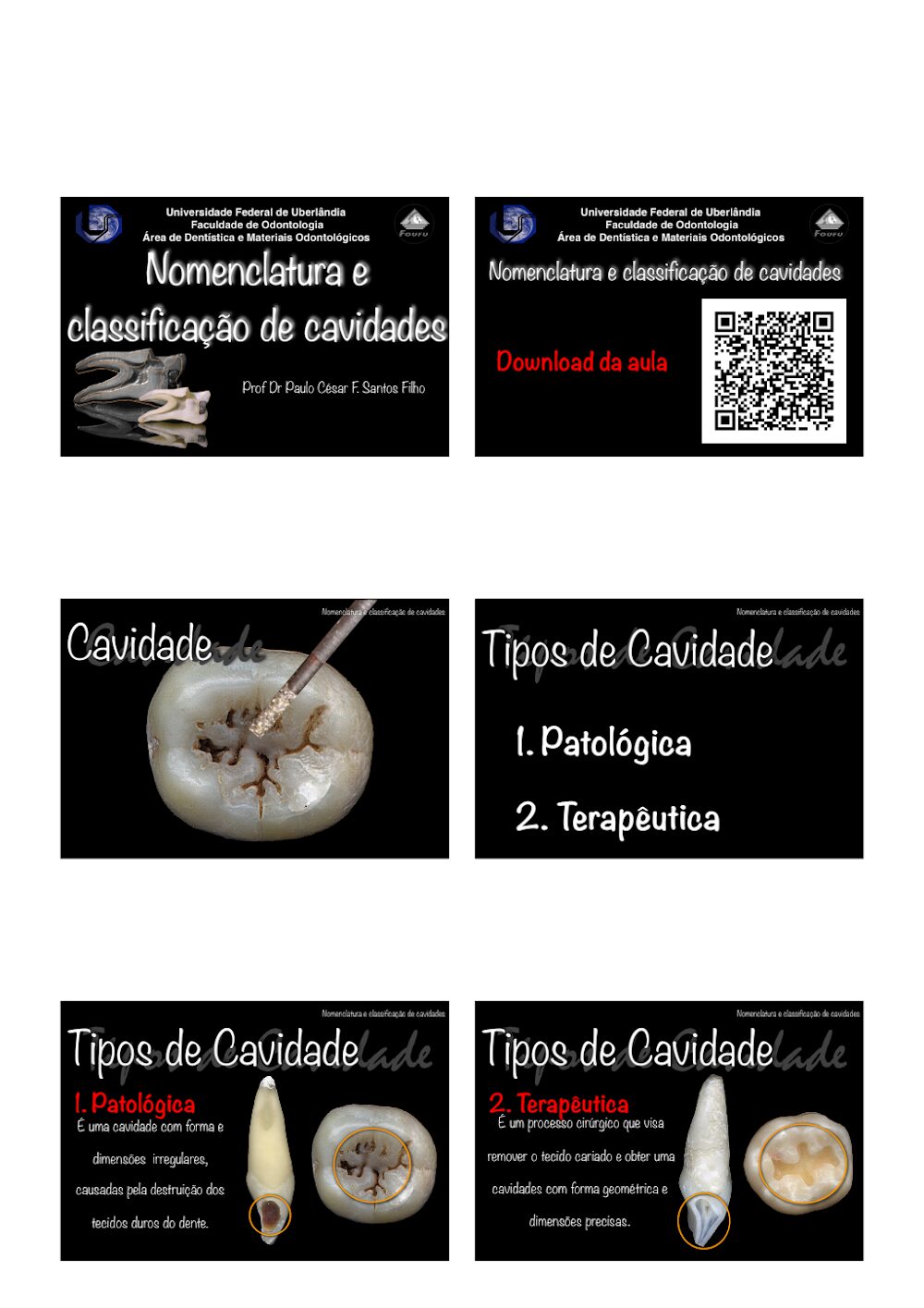 Nomenclatura de Cavidades Dentárias e Classificação Completa