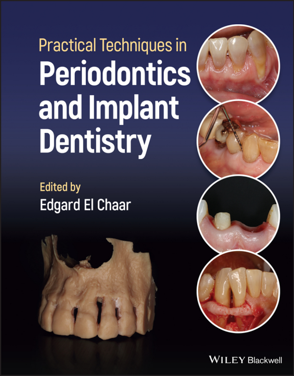 Técnicas Práticas em Periodontia e Implantodontia: Guia Essencial