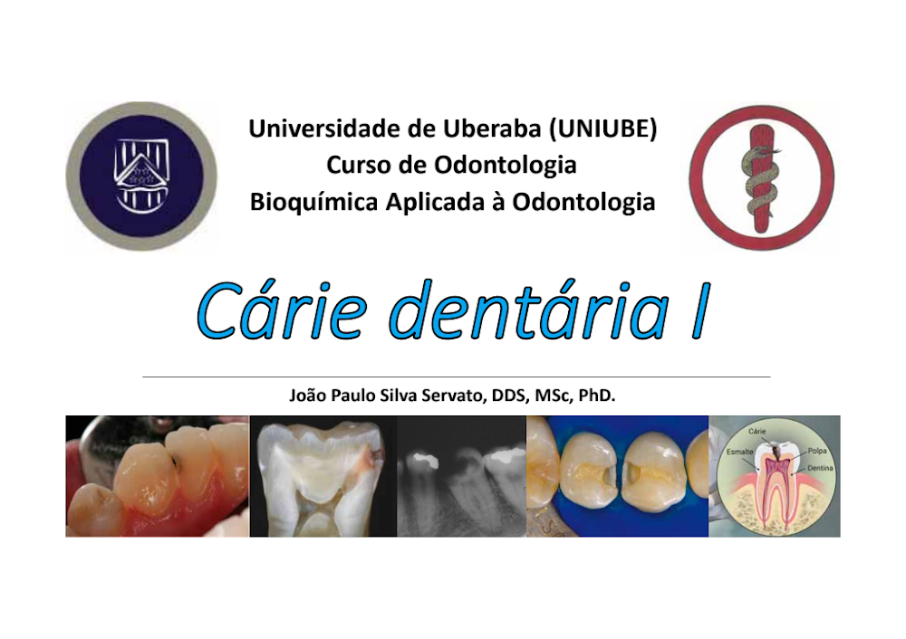 Cárie Dentária: Etiopatogenia, Diagnóstico, Resumo e Questões