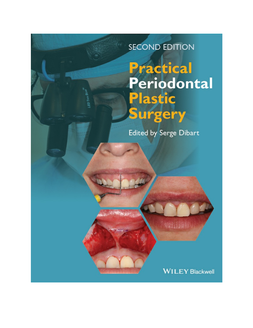 Practical Periodontal Plastic Surgery – 2ª Edição – Serge Dibart