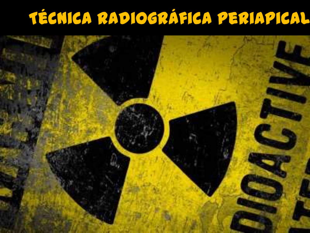 Técnica Radiográfica Periapical: Guia Completo e Segurança
