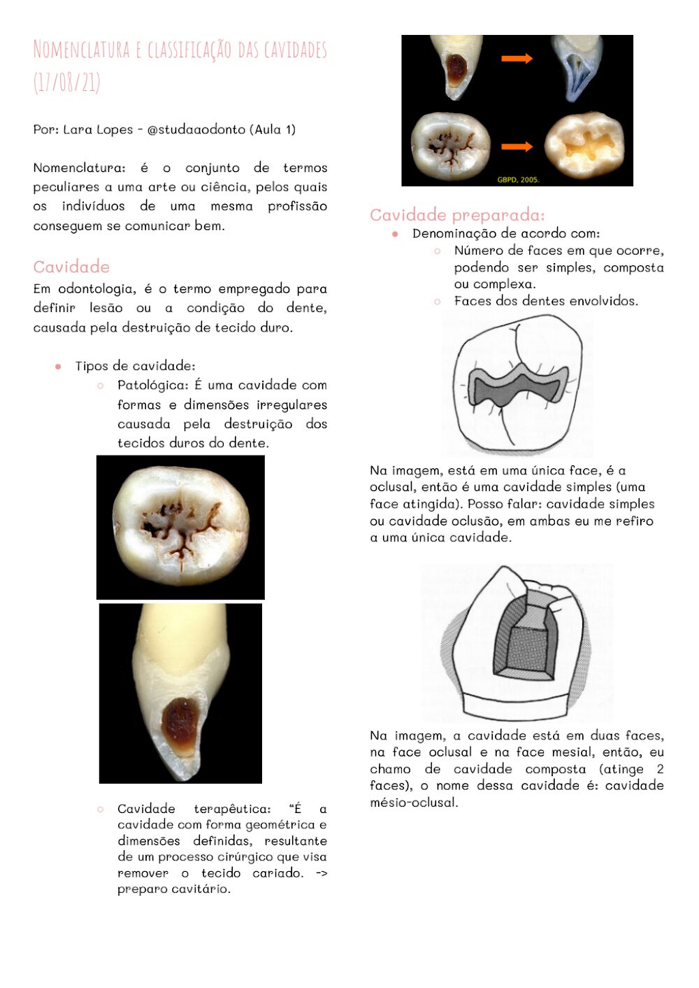 Nomenclatura e Classificação de Cavidades Dentárias