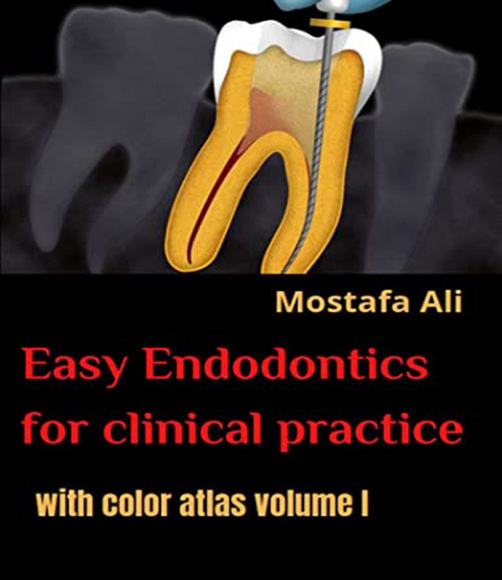 Easy Endodontics: Guia Clínico com Atlas Colorido Vol. I