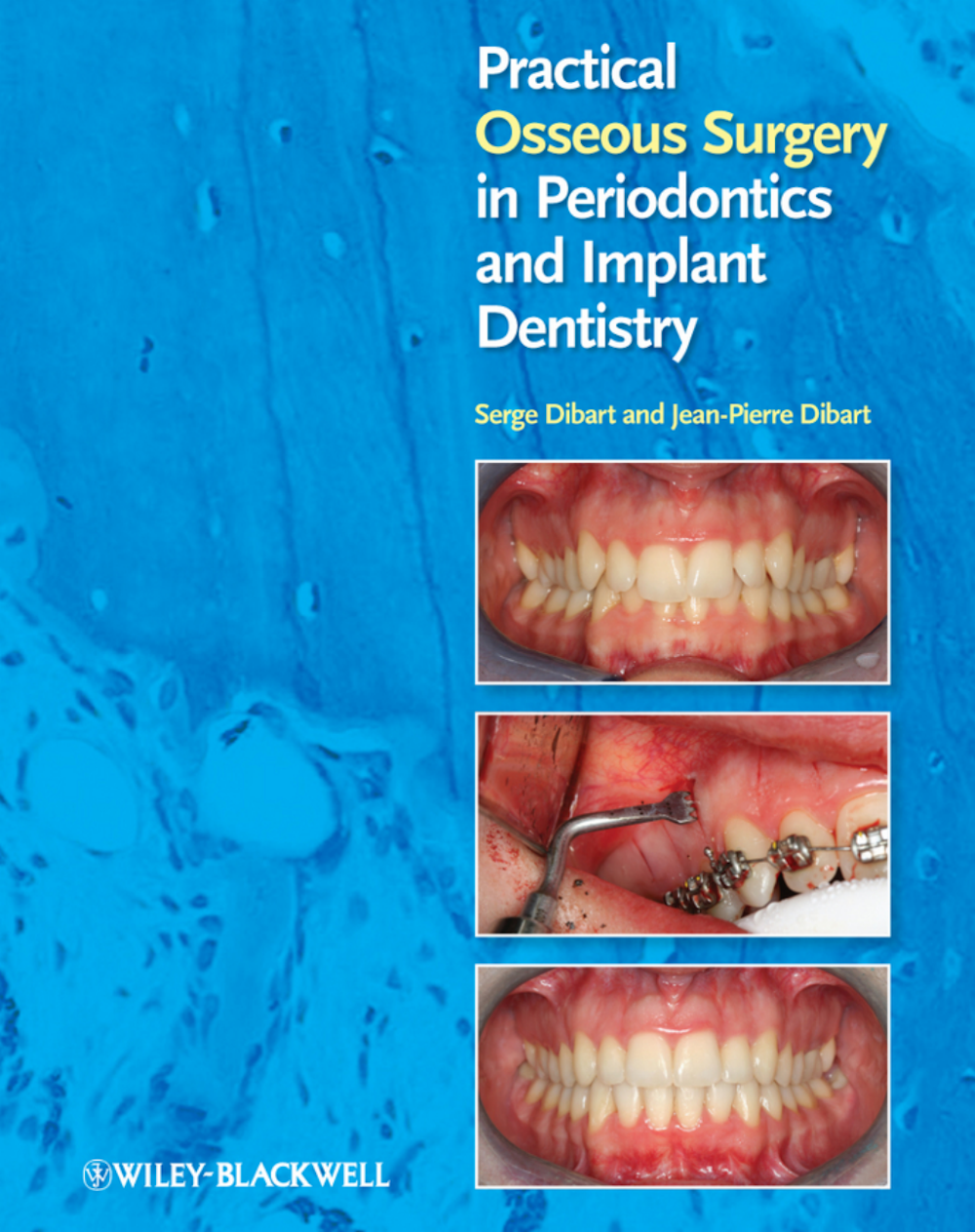 Cirurgia Óssea Prática em Periodontia e Implantodontia