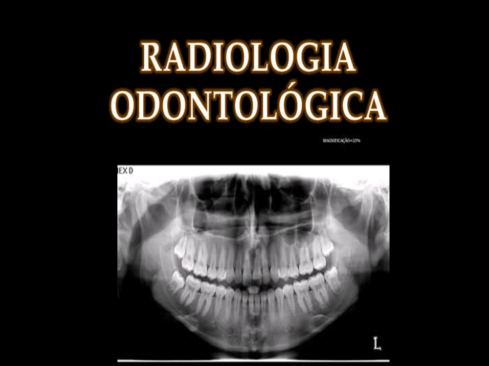 Radiologia Odontológica: Guia Essencial com Radiografia Panorâmica