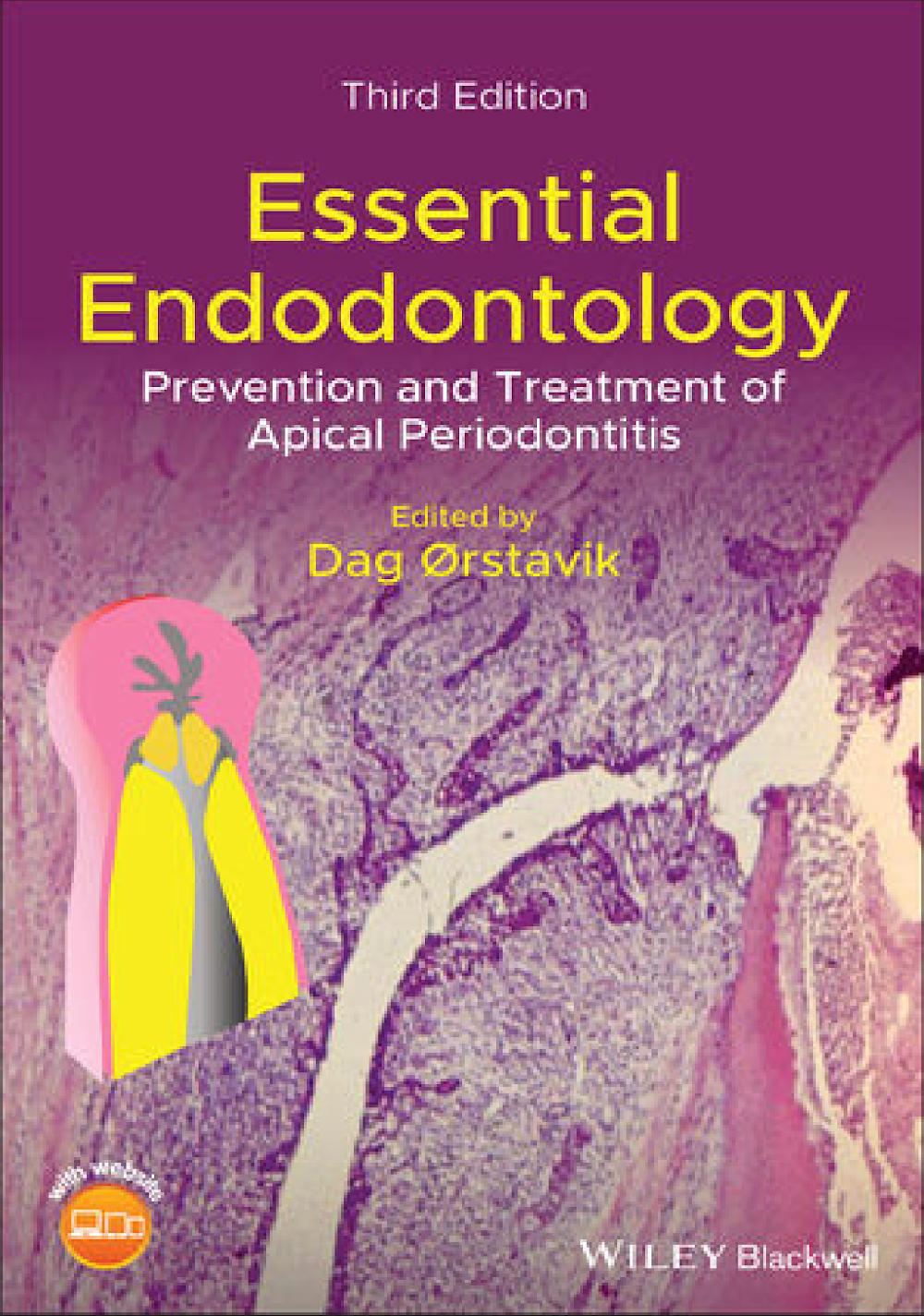Essential Endodontology: Prevenção e Tratamento da Periodontite