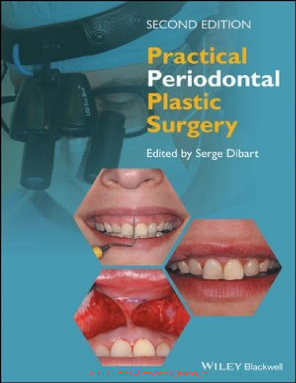 Cirurgia Plástica Periodontal Prática – Segunda Edição