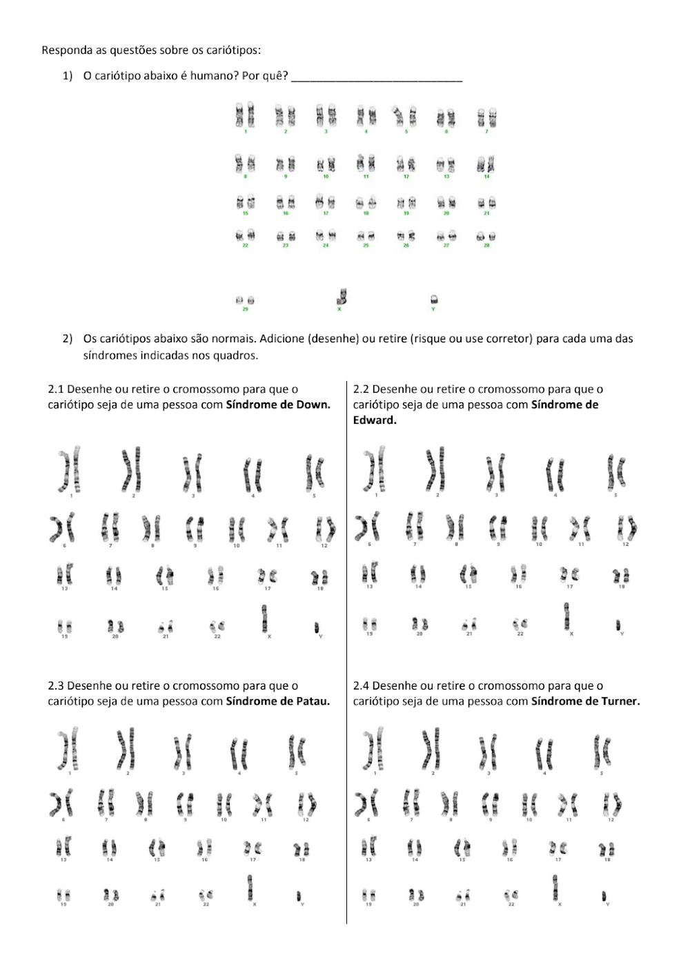 Questões de Biologia: Cariótipos e Síndromes Cromossômicas