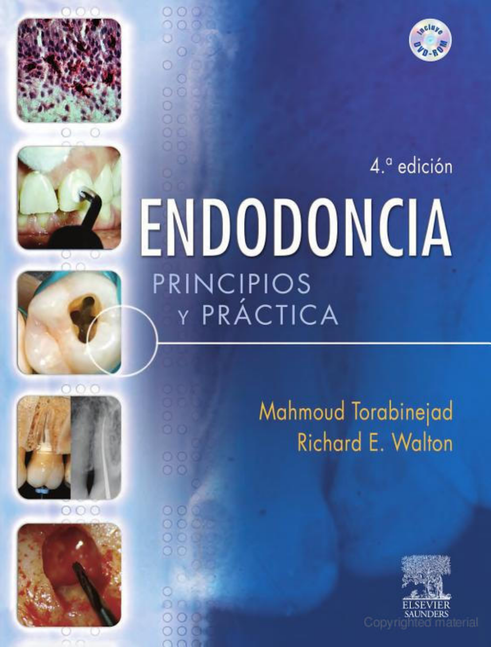 Endodontia: Princípios e Prática – Torabinejad e Walton (4ª Ed.)