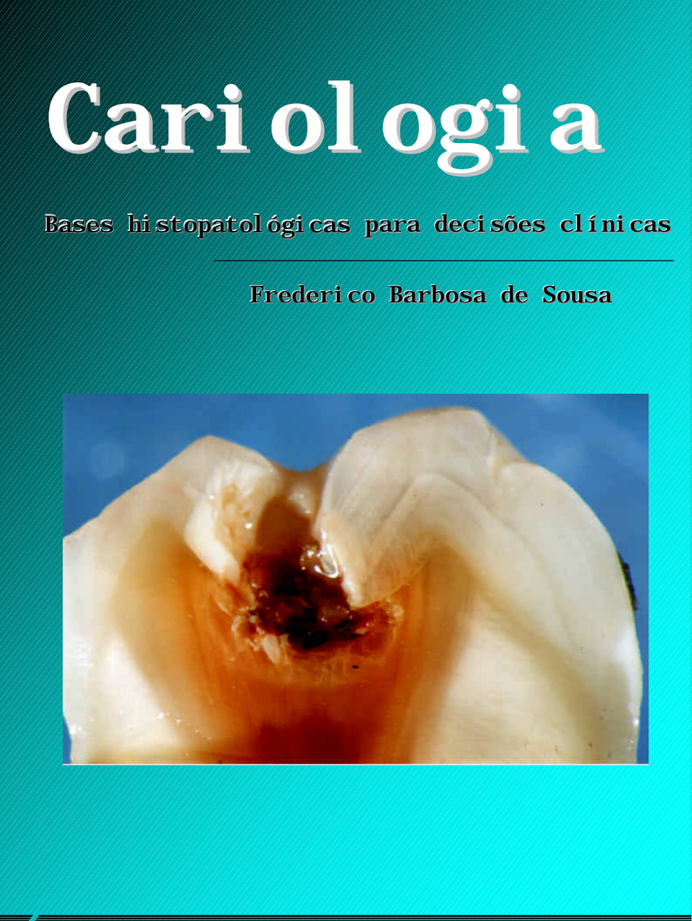 Cariologia: Abordagem Integrada de Prevenção e Tratamento