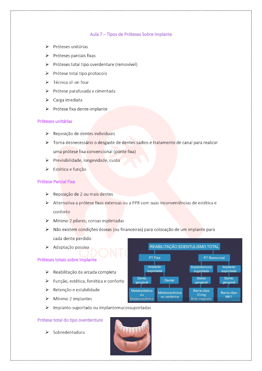 Tipos de Próteses Sobre Implante: Guia e Reabilitação Total