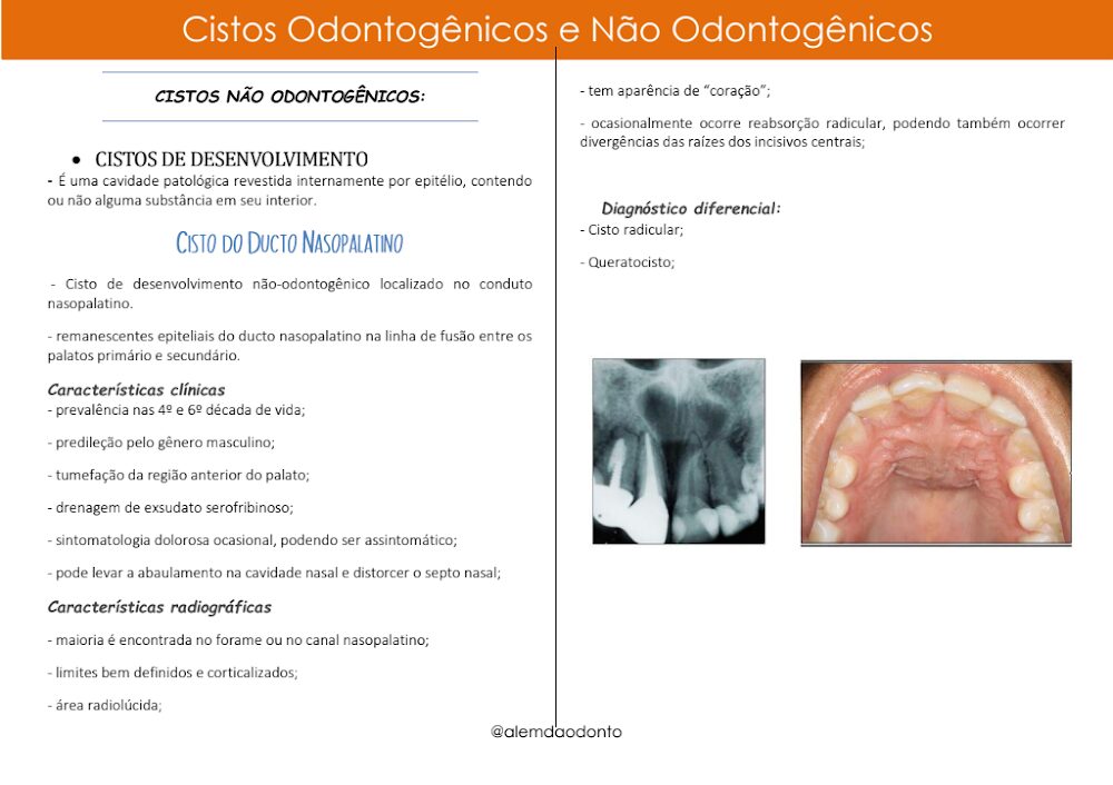 Cisto do Ducto Nasopalatino: Características e Diagnóstico