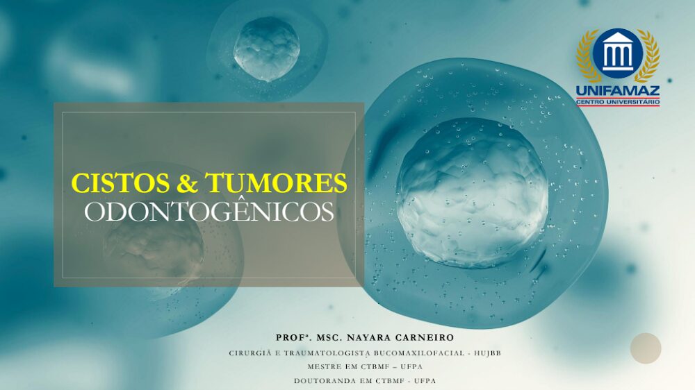 Cistos e Tumores Odontogênicos: Material Profª. Nayara Carneiro