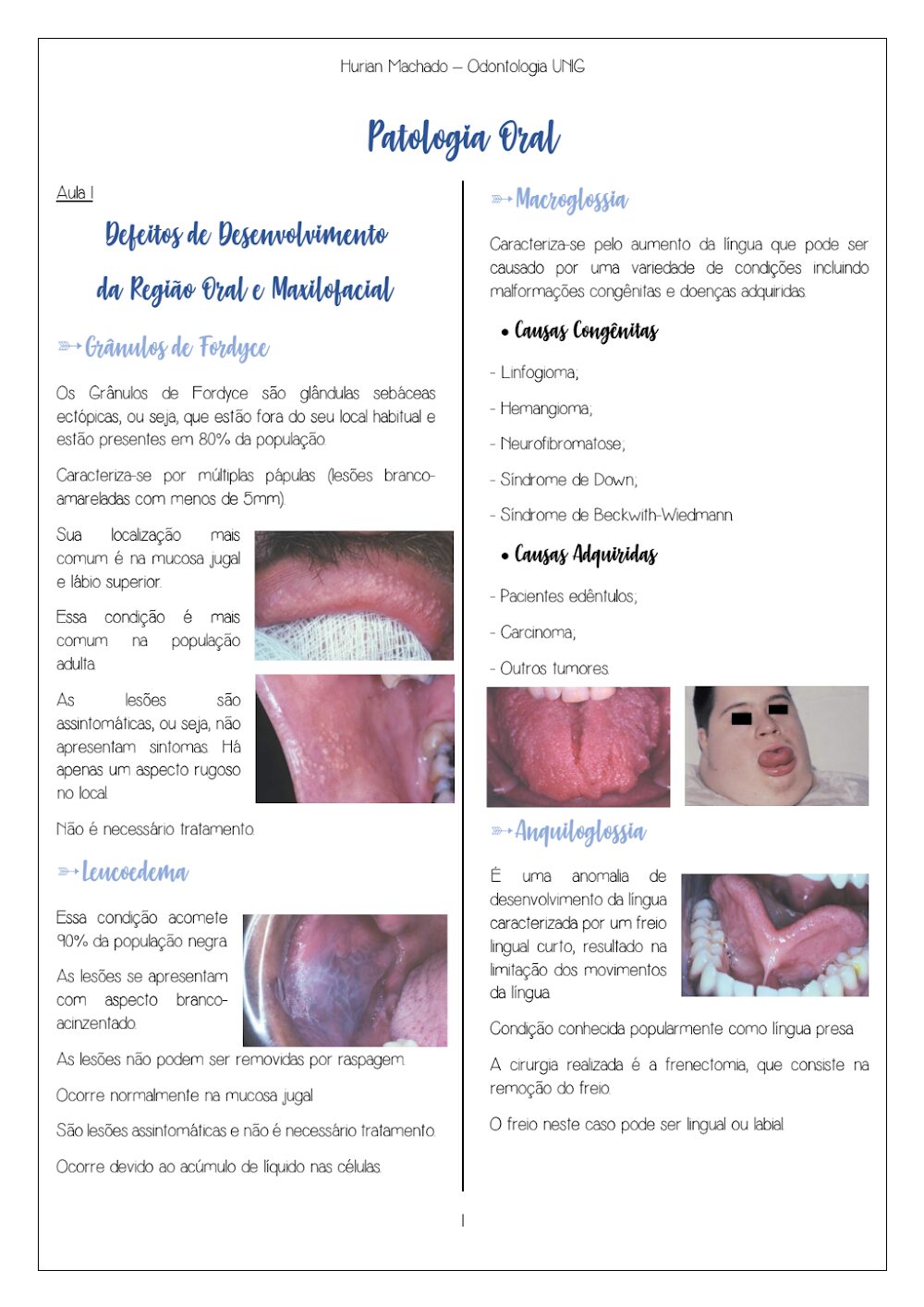 Patologia Oral: Grânulos de Fordyce, Macroglossia e Anquiloglossia