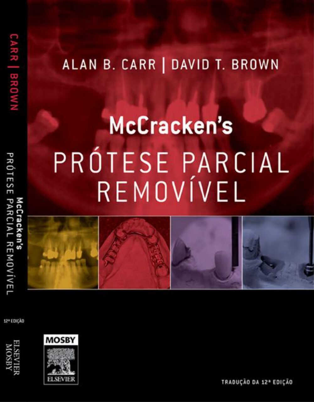 McCracken’s: Prótese Parcial Removível, 12ª Ed. Carr & Brown