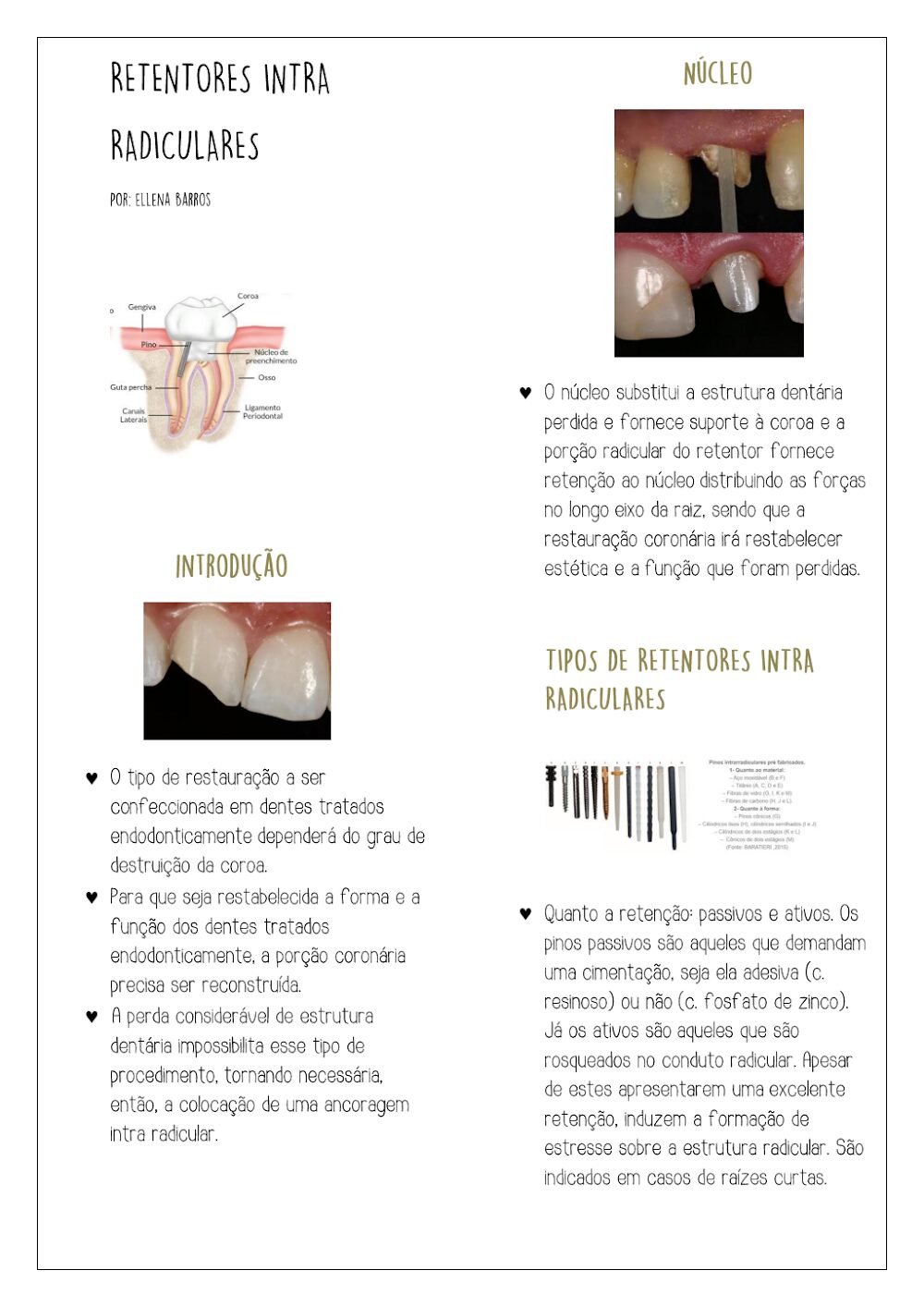 Retentores Intraradiculares: Guia de Aplicação em Odontologia