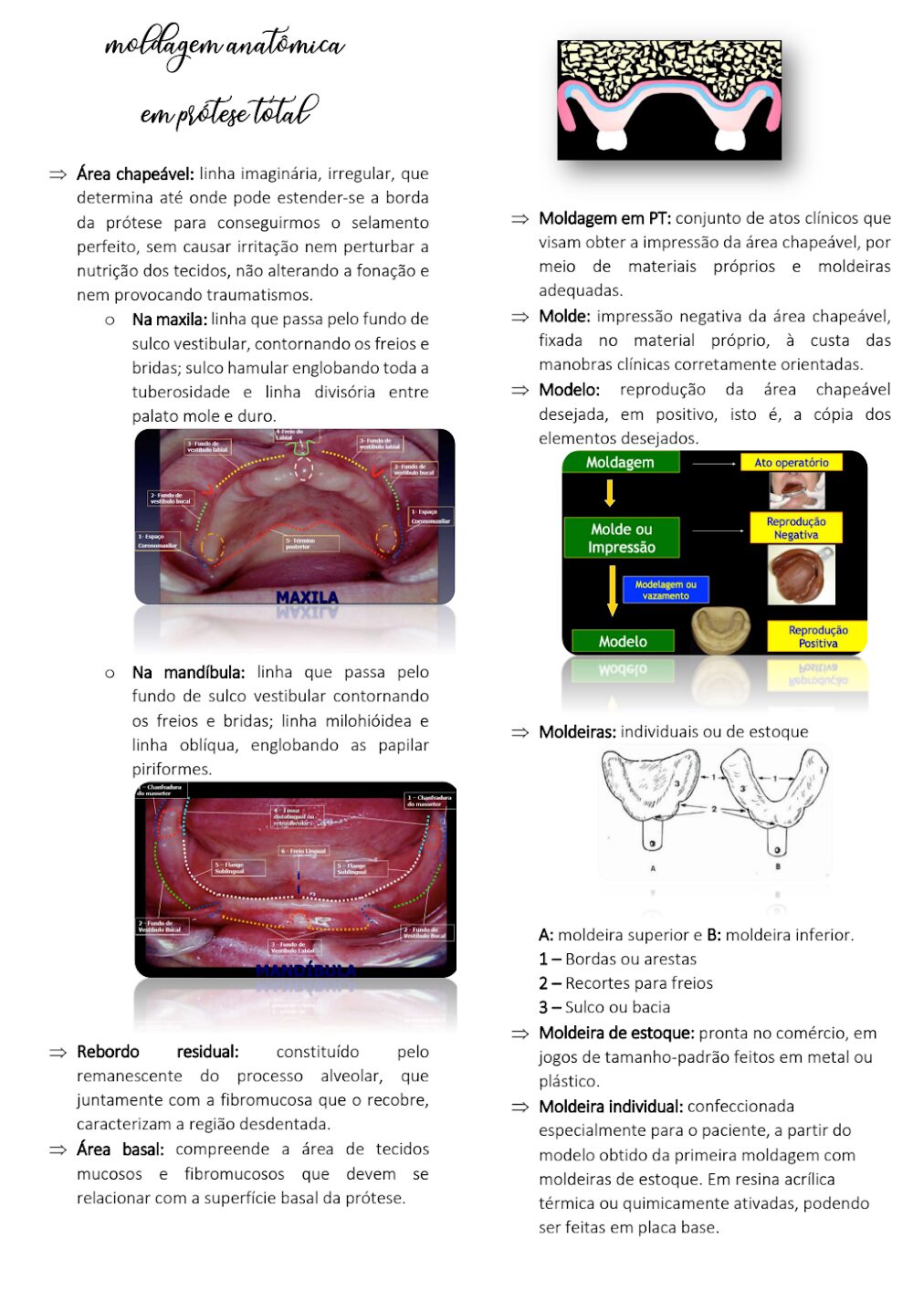 Moldagem Anatômica para Prótese Total: Guia Detalhado