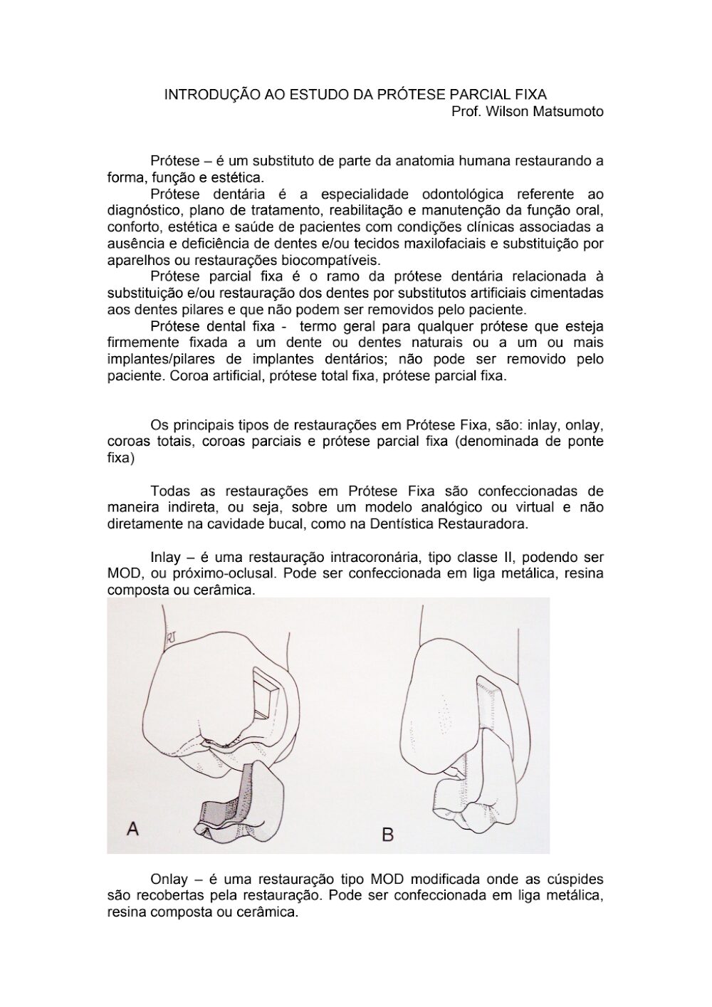 Prótese Parcial Fixa: Introdução Técnica Prof. Wilson Matsumoto