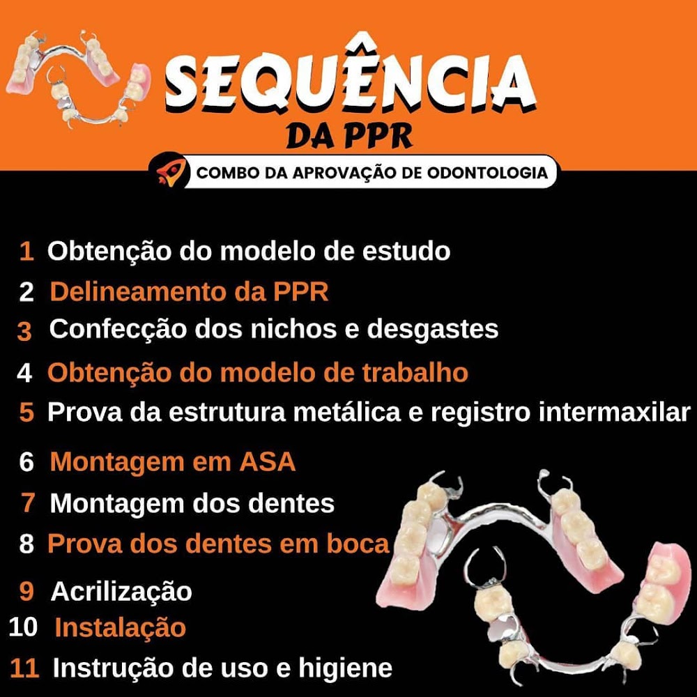 Sequência da PPR: Guia Completo de Prótese Parcial Removível