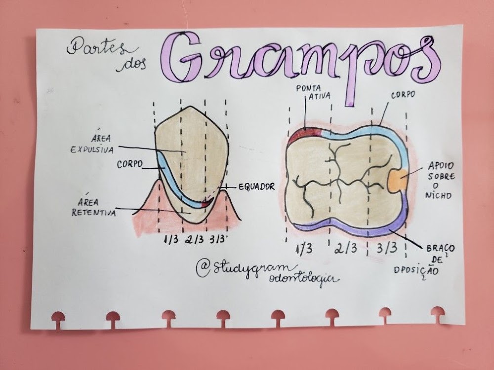 Partes dos Grampos em Prótese Dentária: Guia de Estudo