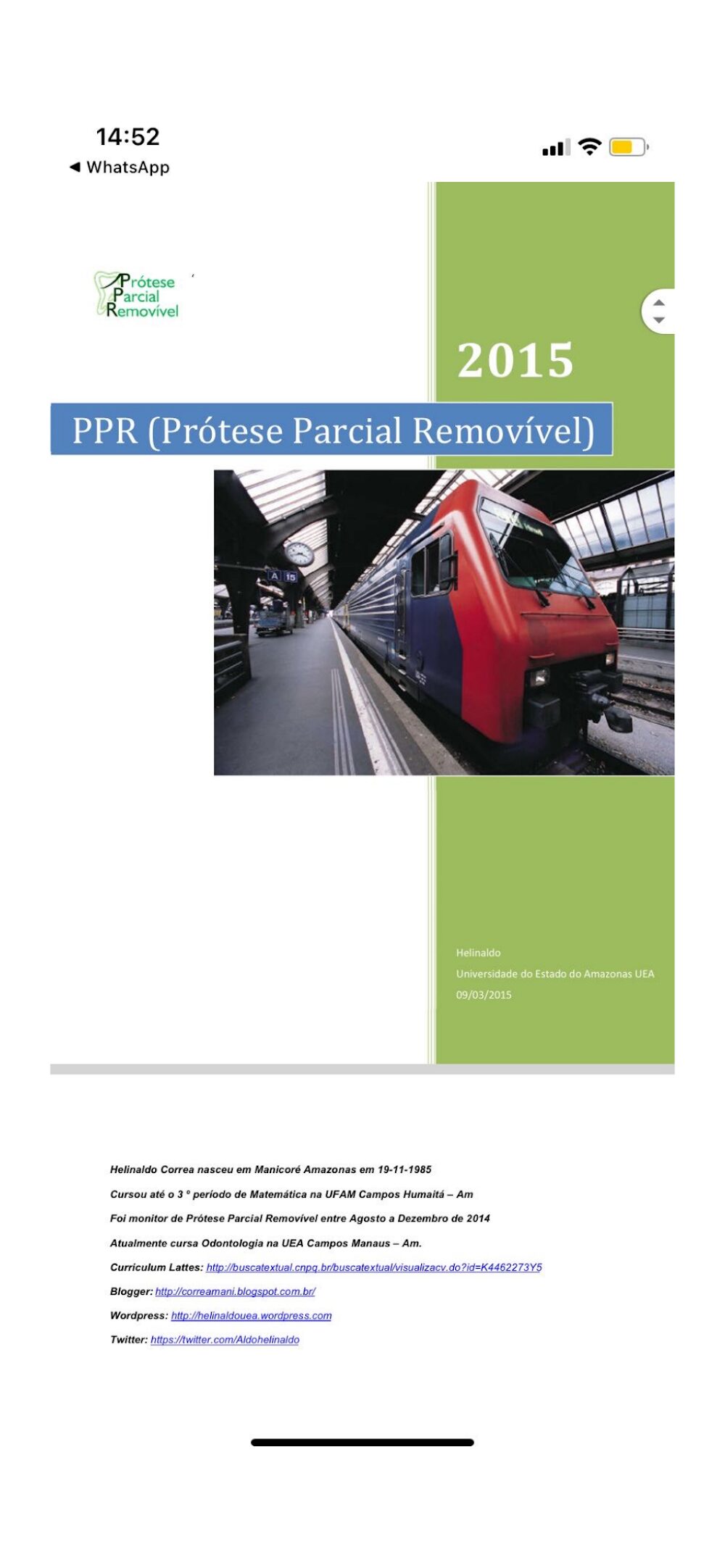 PPR: Resumo Acadêmico de Prótese Parcial Removível (2015)