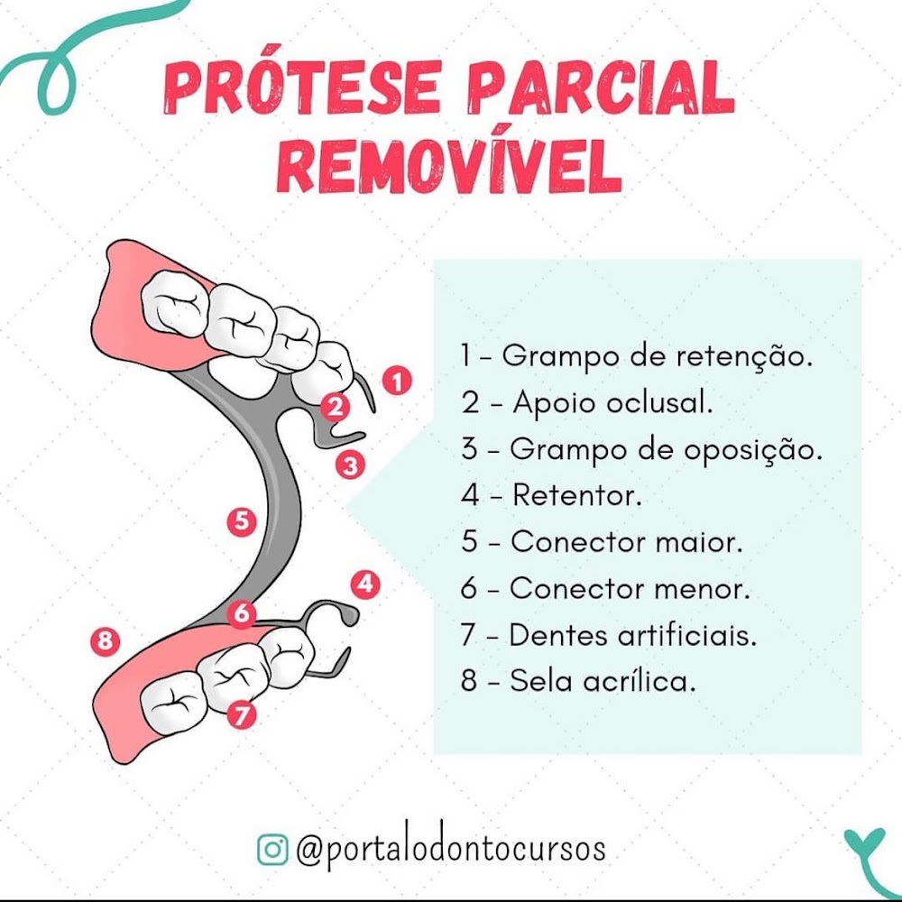 Guia Completo de Prótese Parcial Removível (PPR): Anatomia